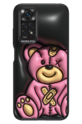 Dead Bear - Xiaomi Redmi Note 11/11S 4G