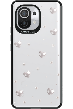 Pearl Tears - Xiaomi Mi 11 5G