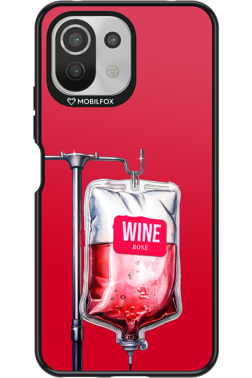 Sos Wine - Xiaomi Mi 11 Lite (2021)