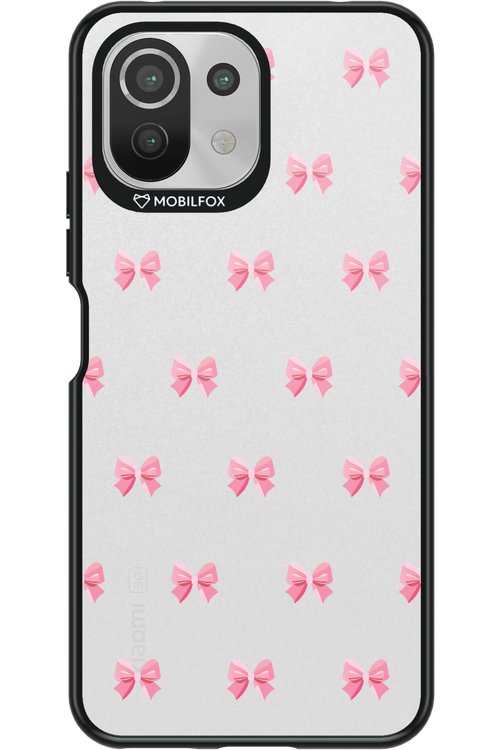 Pinky Bow 2.0 - Xiaomi Mi 11 Lite (2021)