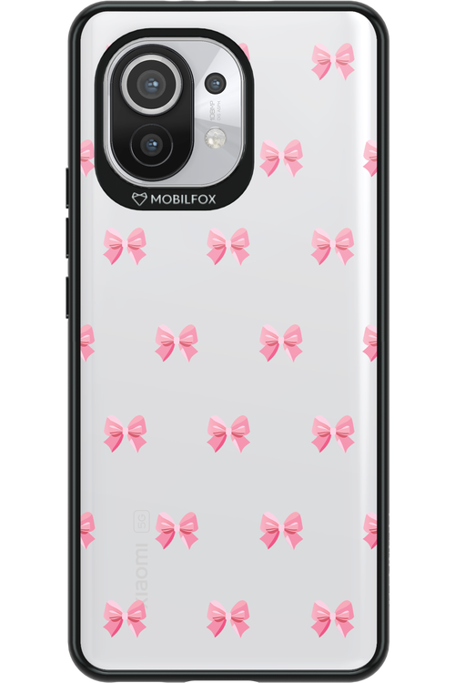 Pinky Bow 2.0 - Xiaomi Mi 11 5G