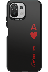 Whole 2.0 - Xiaomi Mi 11 Lite (2021)