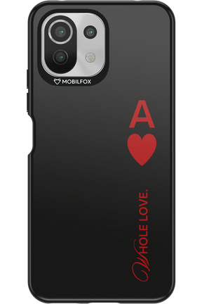 Whole 2.0 - Xiaomi Mi 11 Lite (2021)