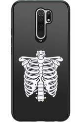 SKELETON - Xiaomi Redmi 9