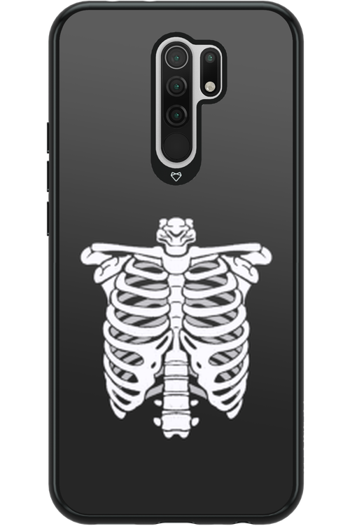 SKELETON - Xiaomi Redmi 9