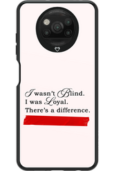 Difference 2.0 - Xiaomi Poco X3 NFC
