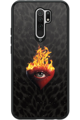 Shit happens - Xiaomi Redmi 9