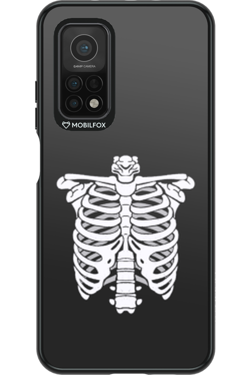 SKELETON - Xiaomi Mi 10T 5G