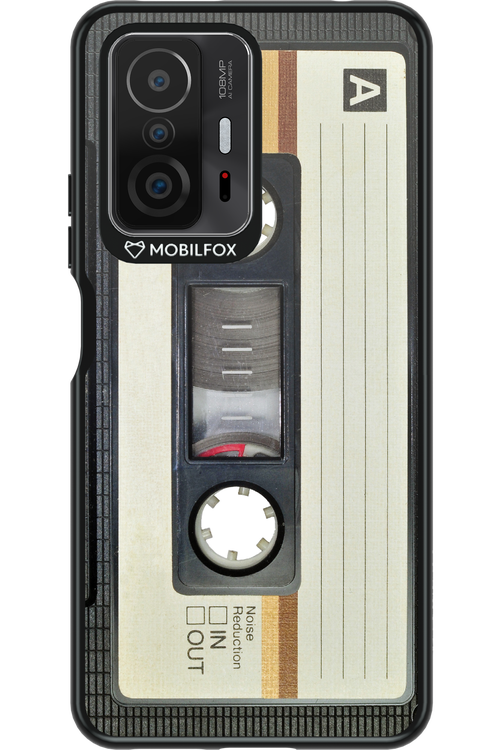 CASE 11 2.0 - Xiaomi Mi 11T
