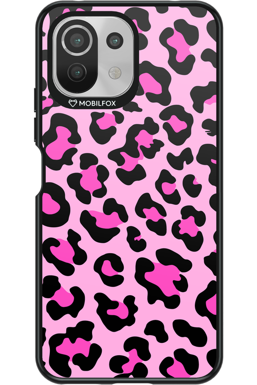 PINK LEOPARD 2.0 - Xiaomi Mi 11 Lite (2021)