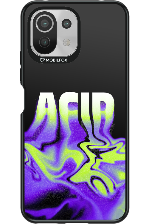 ACIID - Xiaomi Mi 11 Lite (2021)