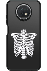 SKELETON - Xiaomi Redmi Note 9T 5G