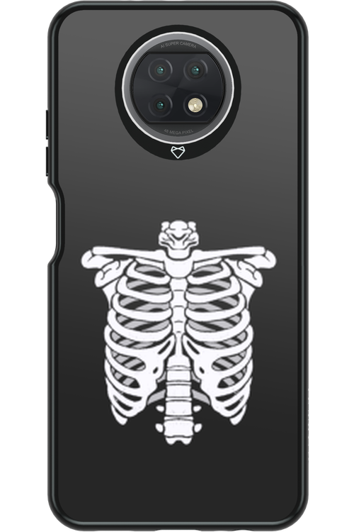 SKELETON - Xiaomi Redmi Note 9T 5G