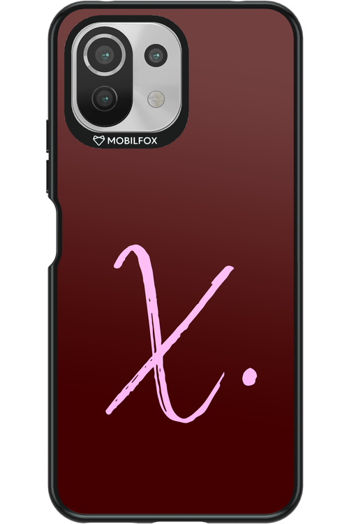 (Dark Blush) X 2.0 - Xiaomi Mi 11 Lite (2021)