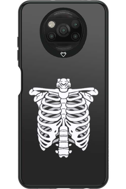 SKELETON - Xiaomi Poco X3 Pro