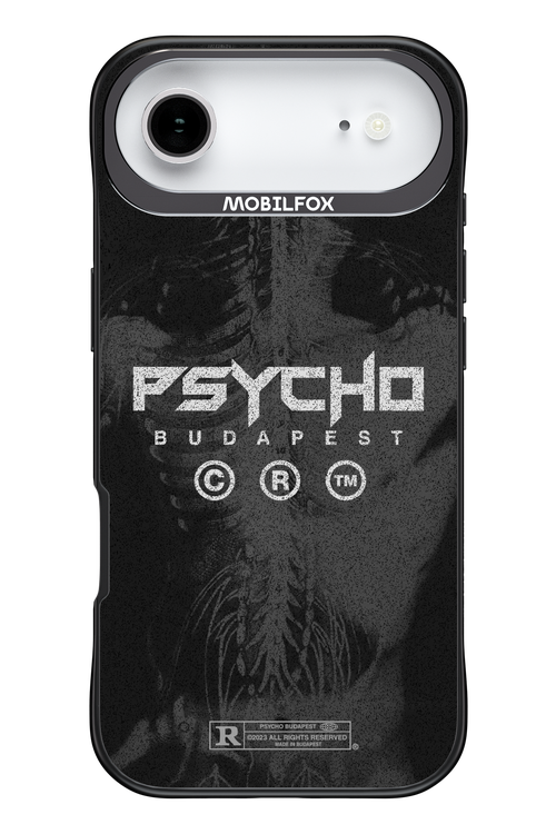 X-Ray - Apple iPhone 17 Air