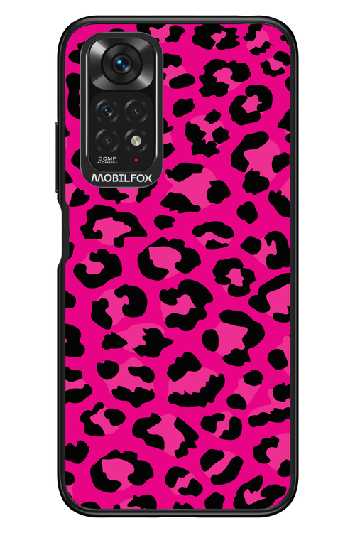 Fuchsia Leopard - Xiaomi Redmi Note 11/11S 4G
