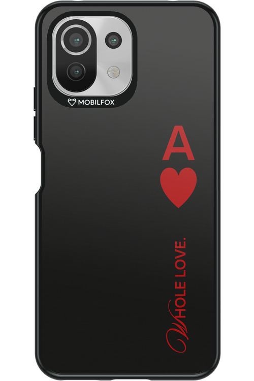 Whole 2.0 - Xiaomi Mi 11 Lite (2021)