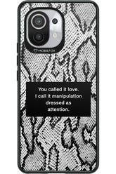 Manipulation - Xiaomi Mi 11 5G