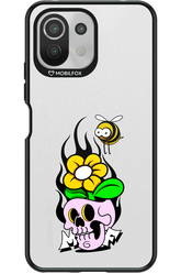 Sugar & Venom - Xiaomi Mi 11 Lite (2021)