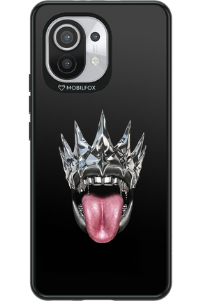 The Diamond King 2.0 - Xiaomi Mi 11 5G