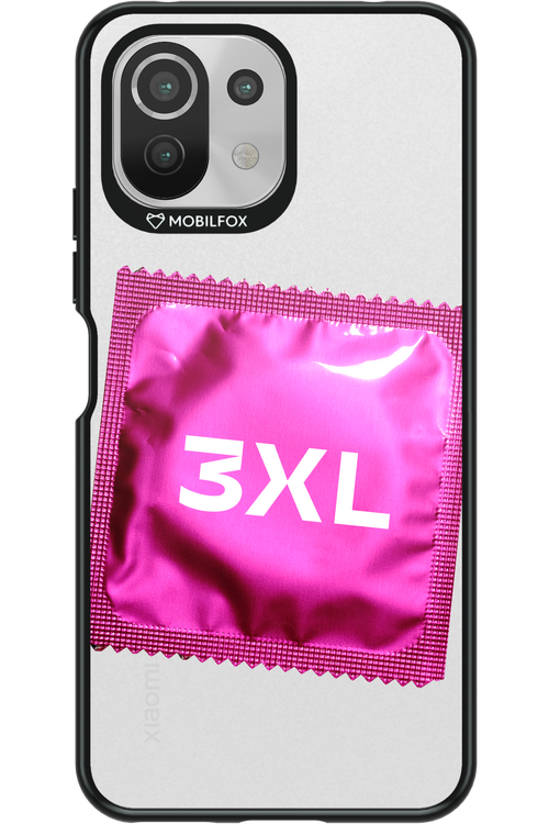 3XL 2.0 - Xiaomi Mi 11 Lite (2021)