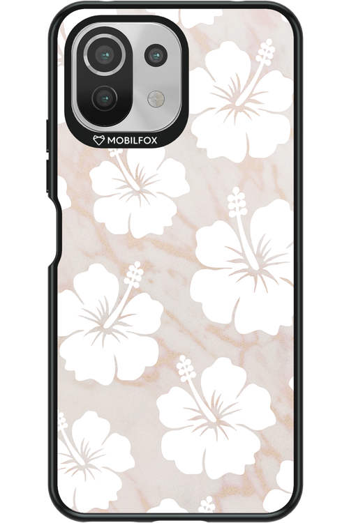 Latte Tropical - Xiaomi Mi 11 Lite (2021)