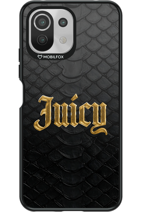 Juicy Gold 2.0 - Xiaomi Mi 11 Lite (2021)