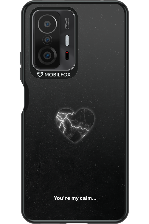 Calm Heart 2.0 - Xiaomi Mi 11T