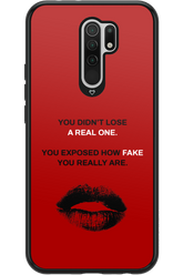 Real or Fake 2.0 - Xiaomi Redmi 9
