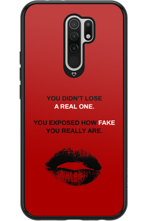 Real or Fake 2.0 - Xiaomi Redmi 9