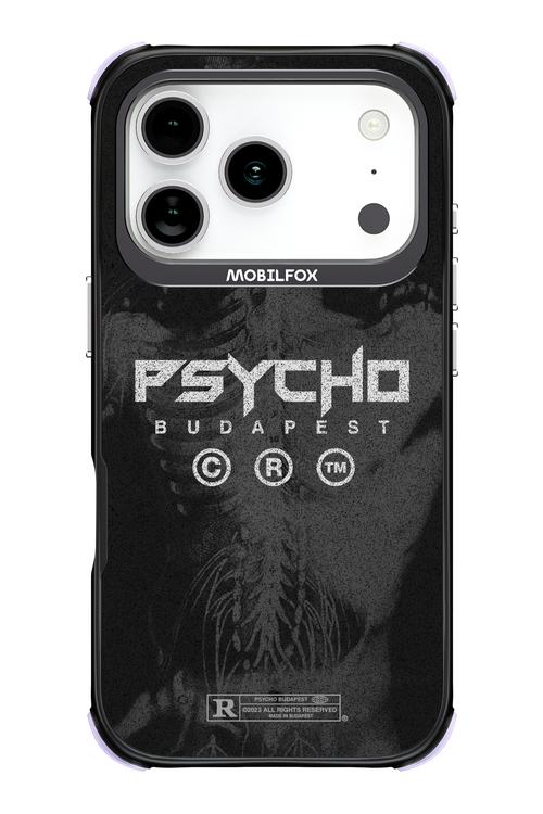 X-Ray - Apple iPhone 17 Pro