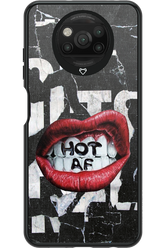 HOT AS F - Xiaomi Poco X3 NFC
