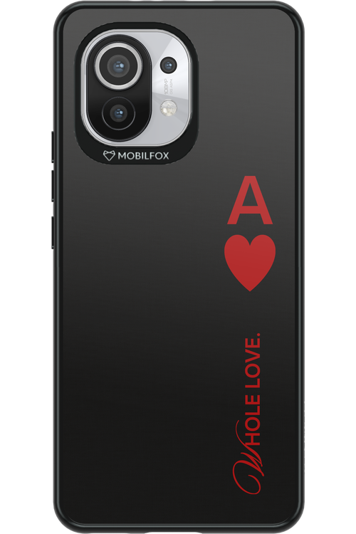Whole 2.0 - Xiaomi Mi 11 5G