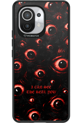 The Watchers - Xiaomi Mi 11 5G