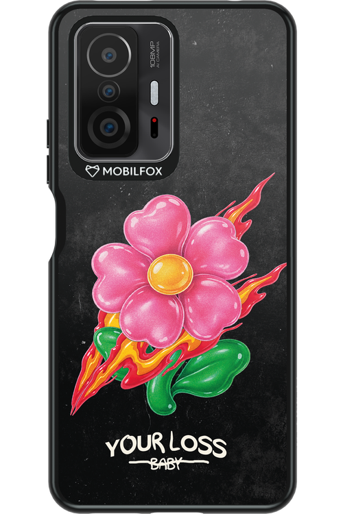 Your Loss 2.0 - Xiaomi Mi 11T Pro