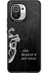 His Heart - Xiaomi Mi 11 5G