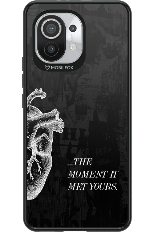 His Heart - Xiaomi Mi 11 5G