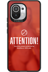 Attention 2.0 - Xiaomi Mi 11 5G